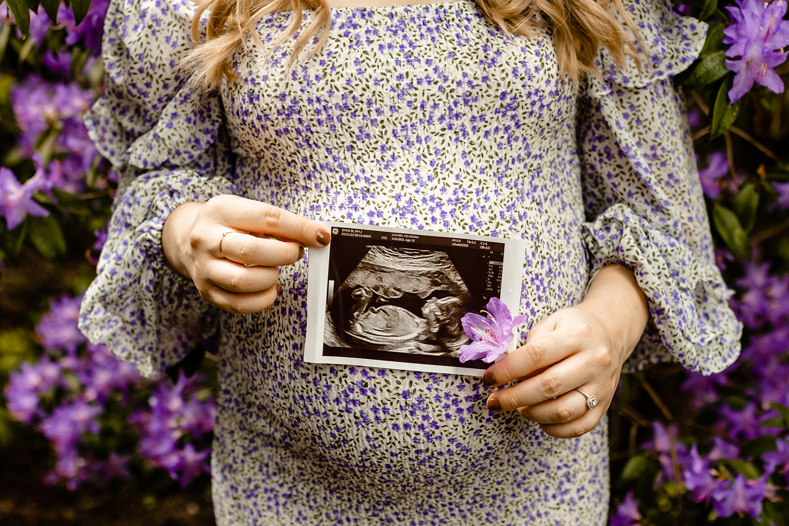 pregnancy annoucements